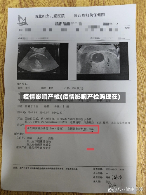 疫情影响产检(疫情影响产检吗现在)