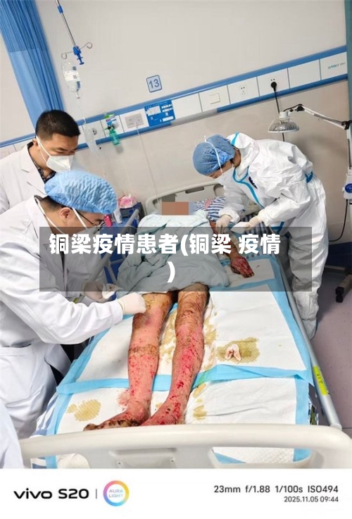 铜梁疫情患者(铜梁 疫情)