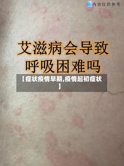 【症状疫情早期,疫情起初症状】