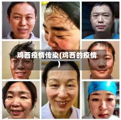 鸡西疫情传染(鸡西的疫情)